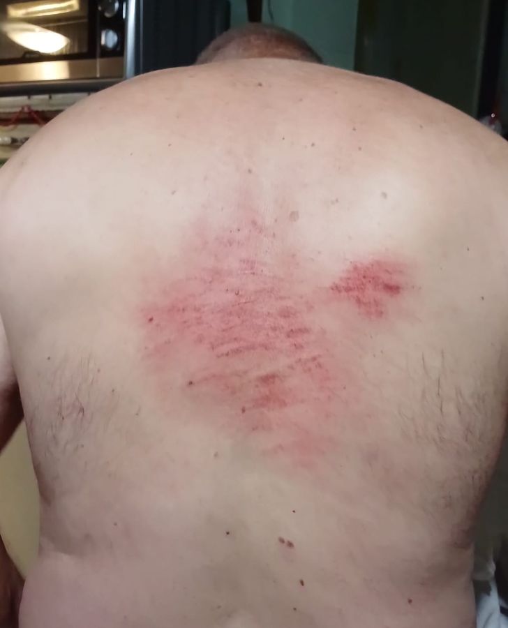 ferite caduta cinghiale