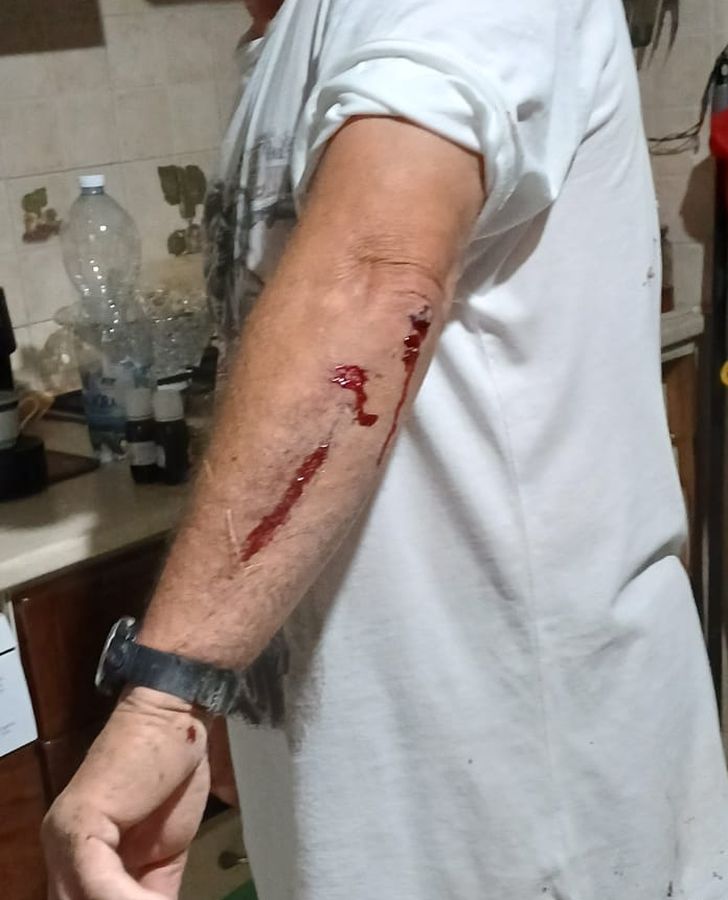 ferite caduta cinghiale 1