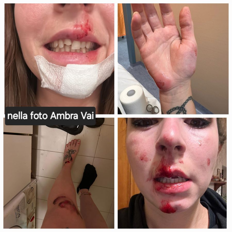 incidente con muflone ambra vai