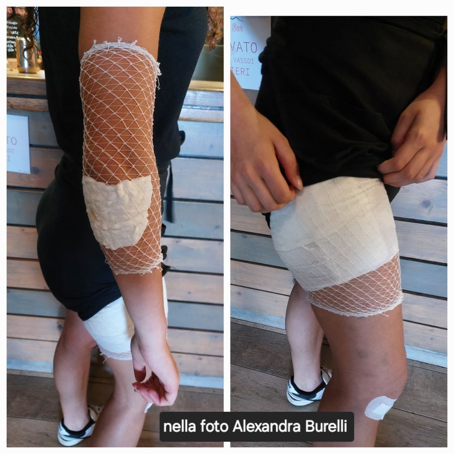 incidente con muflone burelli