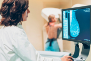 Mammografie: ampliata la platea delle donne che possono fare l&#039;esame. Si va dai 45 ai 74 anni