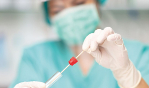 Covid:  752 elbani in quarantena, oggi 47 positivi (29.2% dei 161 tamponi effettuati)