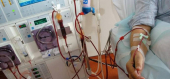 Dialisi in vacanza, la giunta regionale conferma lo stanziamento del 2023
